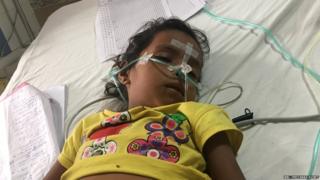 गोरखपुर , इंसेफेलाइटिस