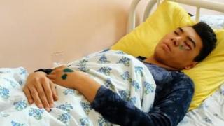 Учак кырсыгынан жабыр тарткан 15 жаштагы Байнур