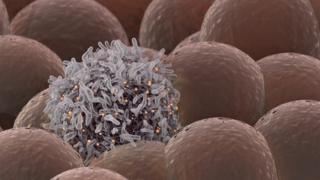 Cancer cell among healthy cells