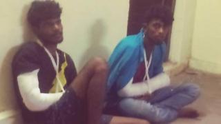 கை முறிந்த நிலையில் இரு கல்லூரி மாணவர்கள்