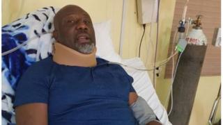Aworan Dino Melaye