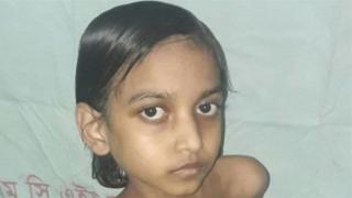 বিরল রোগে আক্রান্ত শিশু মুক্তামণি।