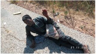 Injured man