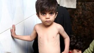 Wani yaro dan Syria
