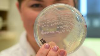 Científico sosteniendo una placa Petri con bacterias