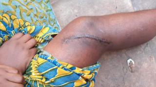 Umwe muri abo bagore bakorewe ico kibi yabwiye BBC ko yipfuza guhunga intara ya Kigoma