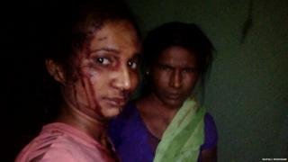 बाघ से भिड़ंत-सेल्फी-रूपाली