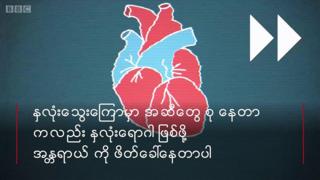 နှလုံးရောဂါ
