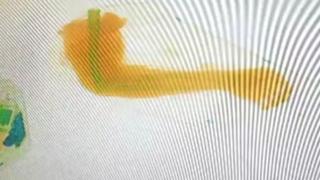 चीन, कटे हाथ