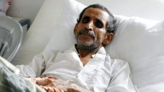 Hakuna sehemu nchini Yemen ambayo haijaathirika na ugonjwa wa kipindupindu