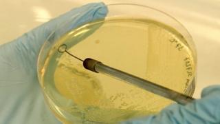 Salmonella bacteria