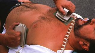 Defibrillator ga chur an sàs
