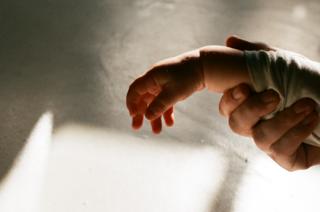 A parent holds a child's arm outward
