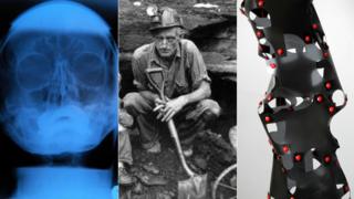 X-ray, miner, sculpture