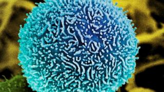 Pancreatic cancer cell
