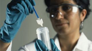 Clinician transferring cells from a scraper to a vial of preservative solution.