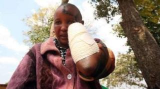 Jackline Mwende alikatwa mikono na mumewe