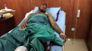 Abantu bakomerekeye mu bikorwa by'ihohotera by'igisirikare bari koroherwa mu bitaro