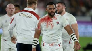A bloodied Billy Vunipola