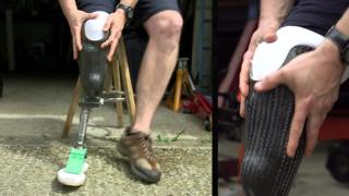 prosthetic leg