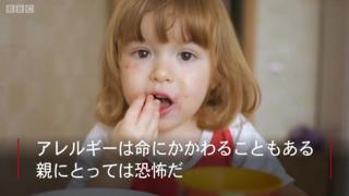 allergy