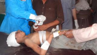 Medics treat an injured bomb blast victim in a hospital in north-western Pakistan. Photo: 16 September 2016