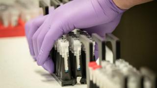 Coronavirus In Scotland: Tracking The First Five Months - BBC News