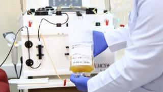 துருக்கியில் கோவிட்-19 நோயில் இருந்து மீண்ட ஒருவரிடம் இருந்து மற்ற நோயாளிகளுக்குத் தருவதற்காக எடுக்கப்படும் பிளாஸ்மா.