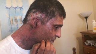 Jameel Muhktar's injuries to his face