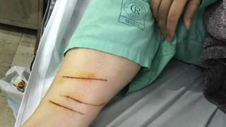 Victim of a violent attack