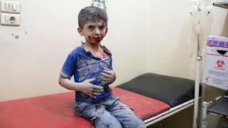 A Syrian boy awaits treatment at a make-shift hospital following air strikes on rebel-held eastern areas of Aleppo on 24 September 2016
