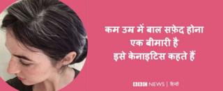 सफेद बाल