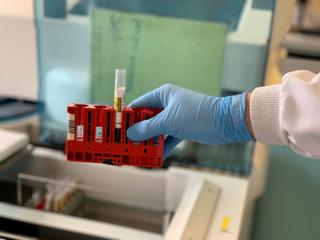 A gloved hand holds a blood sample