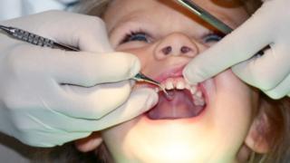 Tooth decay