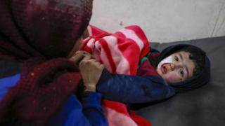 A Syrian child injured in a reported Russian air strike at a hospital in Ariha, Idlib province (30 January 2020)