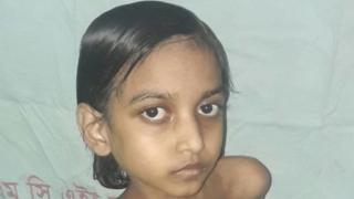 মুক্তামণির বাবা জানাচ্ছেন, একদিন ড্রেসিং না করলেই মুক্তামণির হাত থেকে পোকা বেরিয়ে আসতে শুরু করে। (ফাইল ছবি)