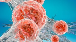 cancer cells
