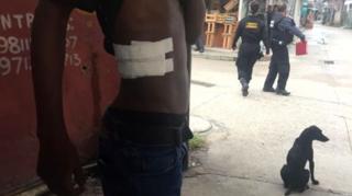 Ajudante de pedreiro tomou tiro que entrou pelas costas e saiu pela costela