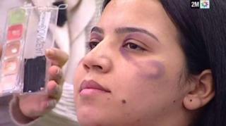 Une chaîne de télévision marocaine s'est excusée après la diffusion d'une émission qui a conseillé aux femmes de cacher les signes de violence domestique à l'aide de maquillage.