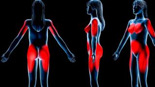 Distribución típica de la grasa en una mujer