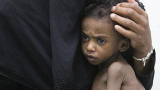 Yemen war