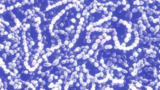 Sepsis