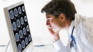 Doctor revisando tomografías cerebrales.