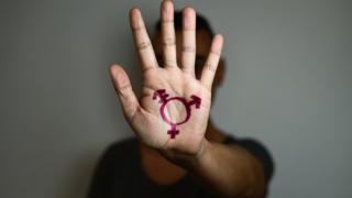 Hombre con varios signos en la mano.