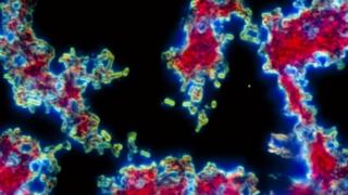Световая микрофотография бактерий Yersinia pestis, вызывающих бубонную чуму или смерть черных людей