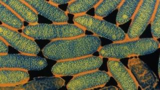Legionnaires Disease
