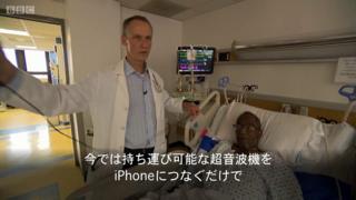 世界を揺るがす――手軽に人体の中をのぞく アプリで超音波検査
