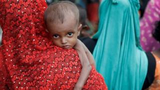 Недоедающий беженец рохинджа в Кокс-Базар, Бангладеш. Фото: 24 сентября 2017 г.