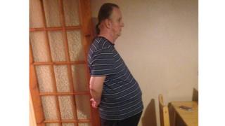 Hernia man 1