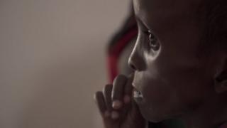 Wiil yar oo macaluul ay ku hayso qeybo ka mid ah Puntland